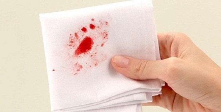 Viêm họng ra máu có thực sự nguy hiểm?
