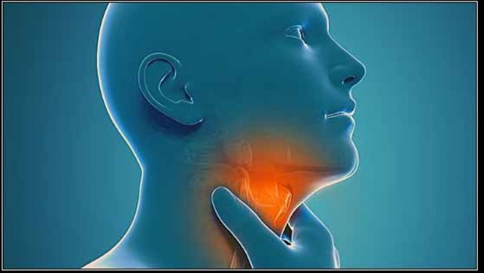 Viêm họng mãn tính – Triệu chứng và cách phòng bệnh