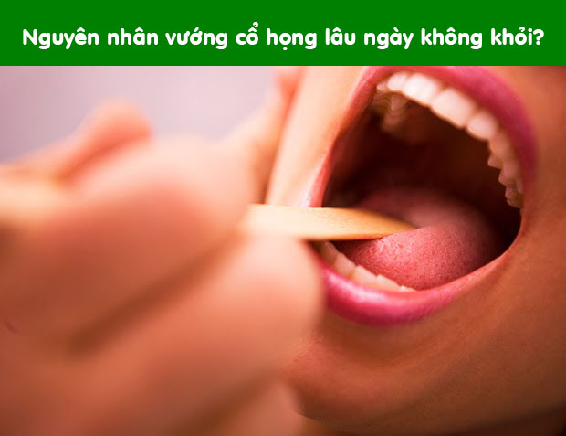 Tìm hiểu nguyên nhân của tình trạng vướng cổ họng lâu ngày